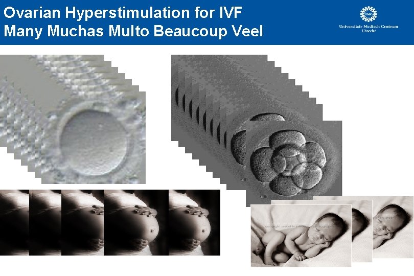 Ovarian Hyperstimulation for IVF Many Muchas Multo Beaucoup Veel Ovarian Hyperstimulation for IVF Many Muchas Multo Beaucoup Veel