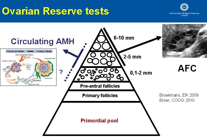 Ovarian Reserve tests Circulating AMH 6 -10 mm 2 -5 mm ? 0, 1 Ovarian Reserve tests Circulating AMH 6 -10 mm 2 -5 mm ? 0, 1