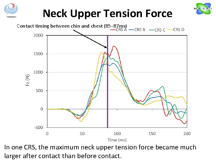 Neck Upper Tension Force Contact timing between chin and chest (85– 87 ms) In