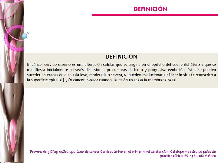 DEFINICIÓN Prevención y Diagnostico oportuno de cáncer Cervicouterino en el primer nivel de atención.