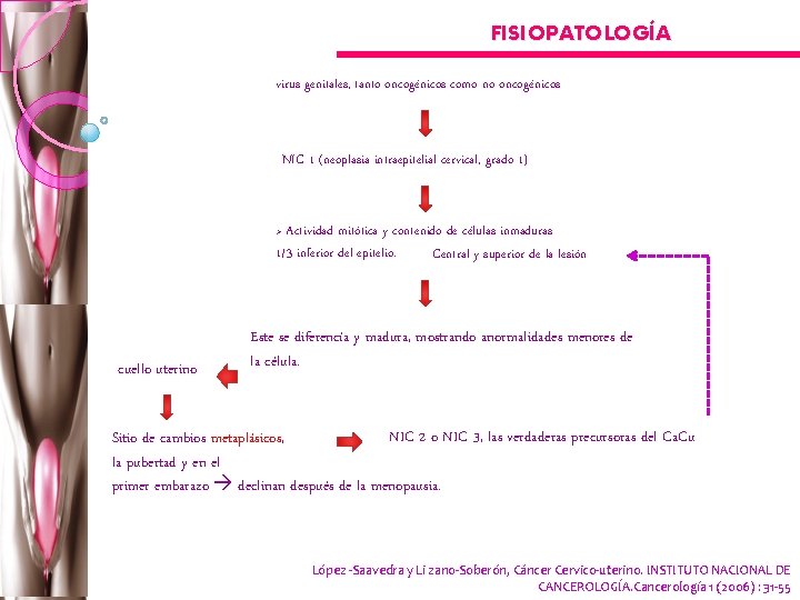 FISIOPATOLOGÍA virus genitales, tanto oncogénicos como no oncogénicos NIC 1 (neoplasia intraepitelial cervical, grado