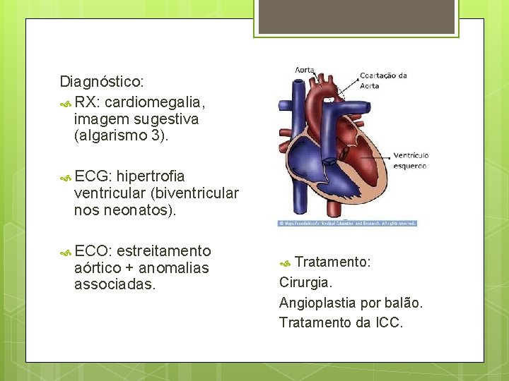 Diagnóstico: RX: cardiomegalia, imagem sugestiva (algarismo 3). ECG: hipertrofia ventricular (biventricular nos neonatos). ECO: