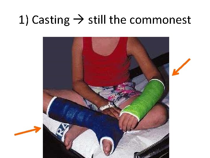 1) Casting still the commonest 