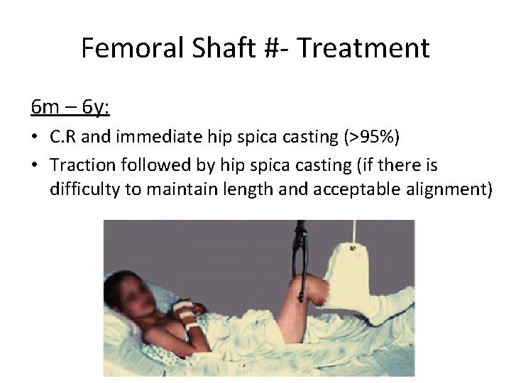 Femoral Shaft #- Treatment 6 m – 6 y: • C. R and immediate