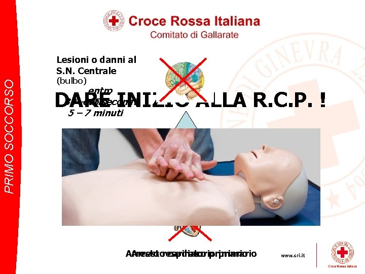 PRIMO SOCCORSO Lesioni o danni al S. N. Centrale (bulbo) entro 30 –entro 45
