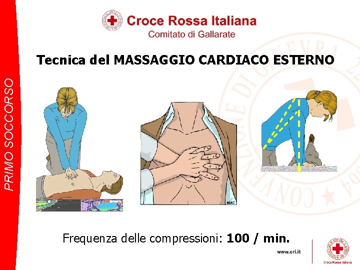 PRIMO SOCCORSO Tecnica del MASSAGGIO CARDIACO ESTERNO Frequenza delle compressioni: 100 / min. 