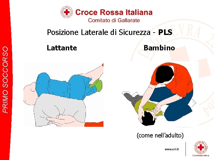 PRIMO SOCCORSO Posizione Laterale di Sicurezza - PLS Lattante Bambino (come nell’adulto) 