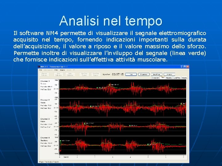 Analisi nel tempo Il software NM 4 permette di visualizzare il segnale elettromiografico acquisito