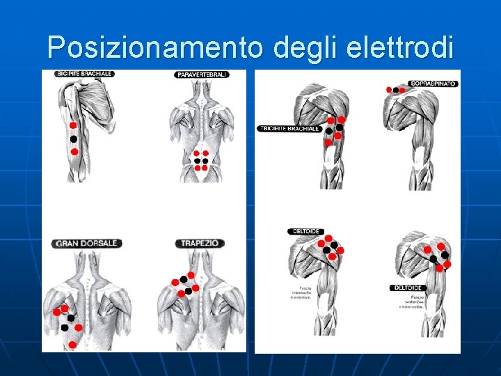 Posizionamento degli elettrodi 