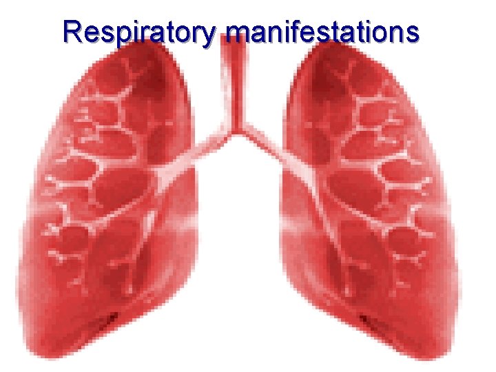 Respiratory manifestations 