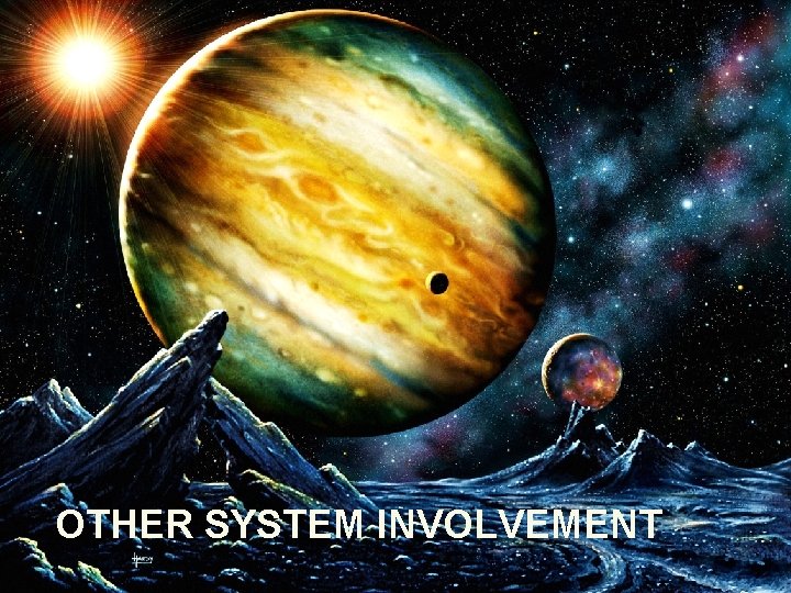 OTHER SYSTEM INVOLVEMENT 