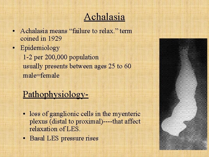 Achalasia • Achalasia means “failure to relax. ” term coined in 1929 • Epidemiology