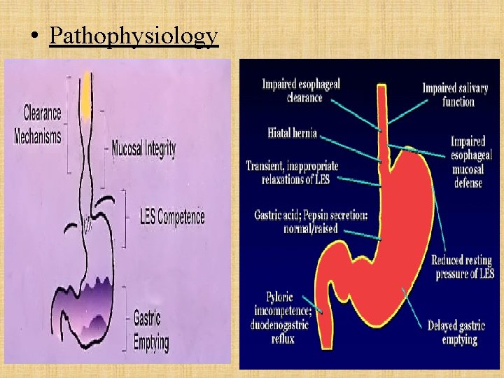  • Pathophysiology 