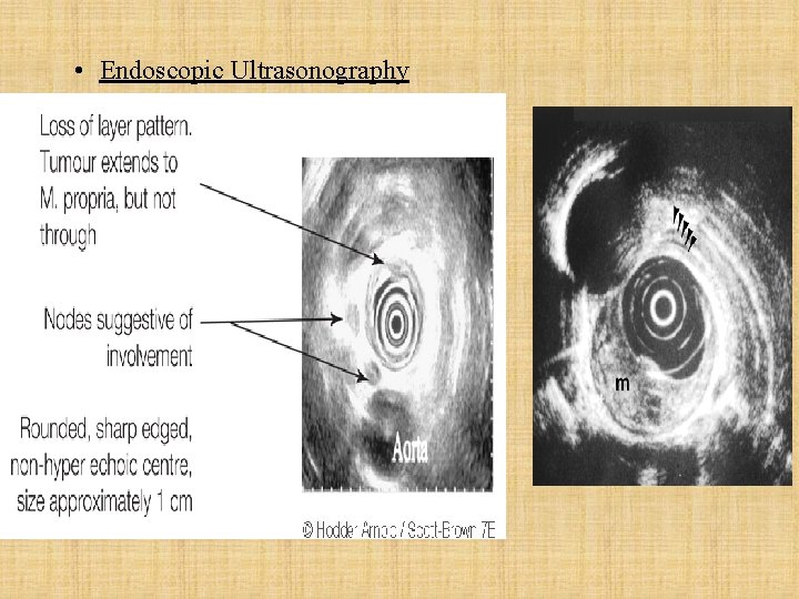  • Endoscopic Ultrasonography 