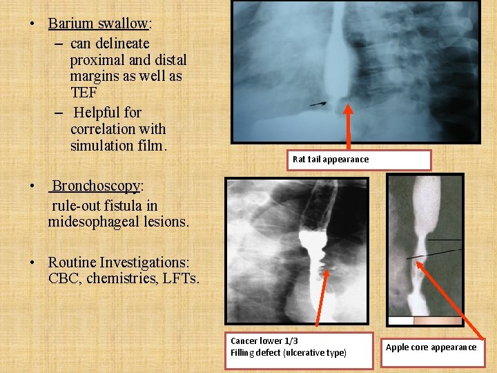  • Barium swallow: – can delineate proximal and distal margins as well as