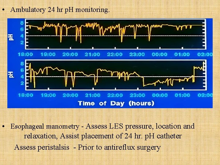  • Ambulatory 24 hr p. H monitoring. • Esophageal manometry - Assess LES