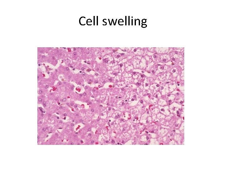 Cell swelling 