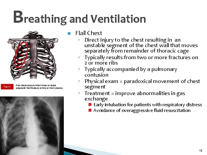 Breathing and Ventilation n Flail Chest ◦ Direct injury to the chest resulting in