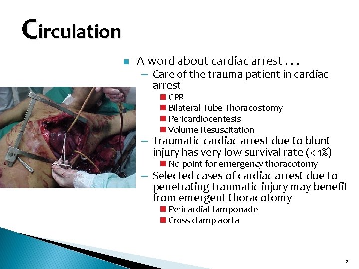 Circulation n A word about cardiac arrest. . . – Care of the trauma