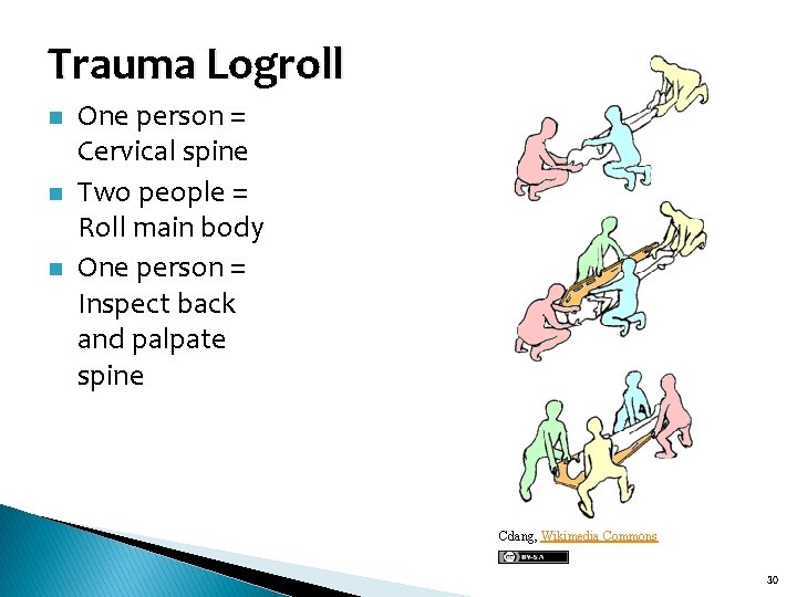 Trauma Logroll n n n One person = Cervical spine Two people = Roll