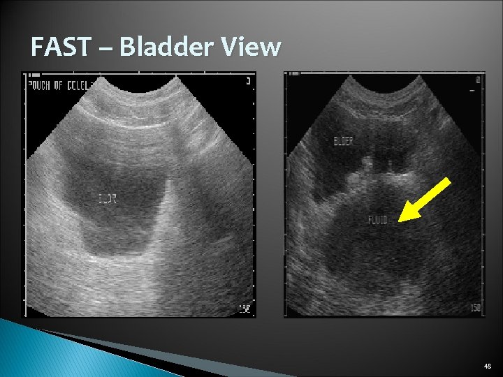 FAST – Bladder View 48 