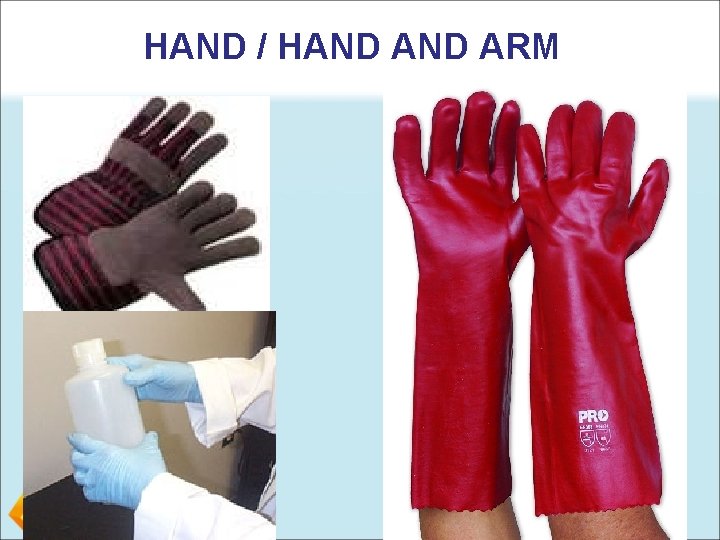 HAND / HAND ARM 