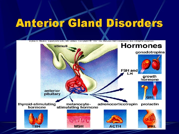 Anterior Gland Disorders 