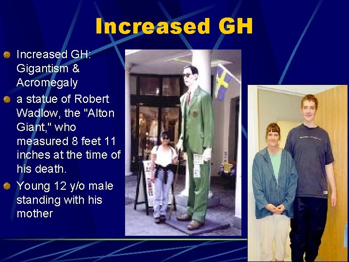 Increased GH: Gigantism & Acromegaly a statue of Robert Wadlow, the "Alton Giant, "