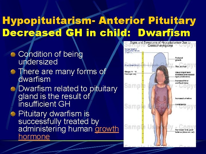 Hypopituitarism- Anterior Pituitary Decreased GH in child: Dwarfism Condition of being undersized There are