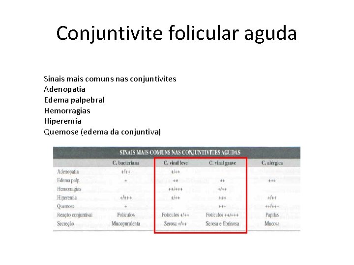 Conjuntivite folicular aguda Sinais mais comuns nas conjuntivites Adenopatia Edema palpebral Hemorragias Hiperemia Quemose