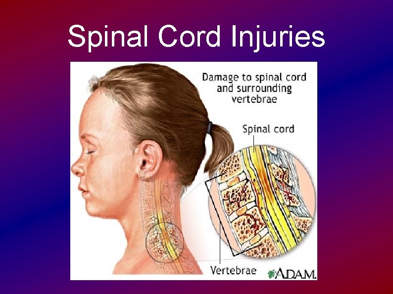 Spinal Cord Injuries 