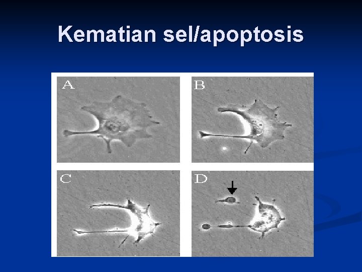 Kematian sel/apoptosis 
