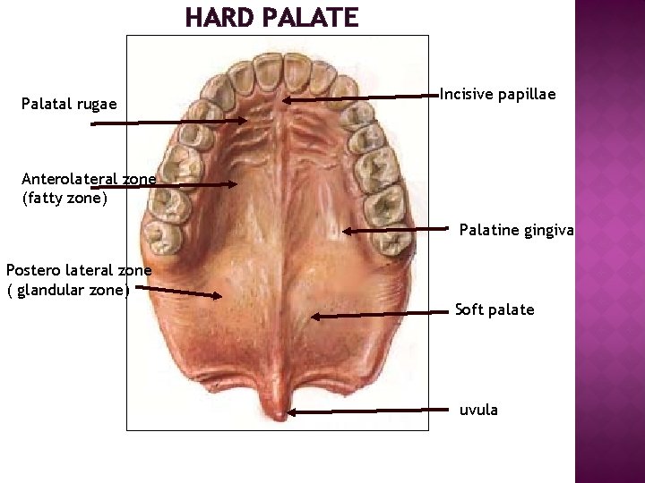 HARD PALATE Palatal rugae Incisive papillae Anterolateral zone (fatty zone) Palatine gingiva Postero lateral