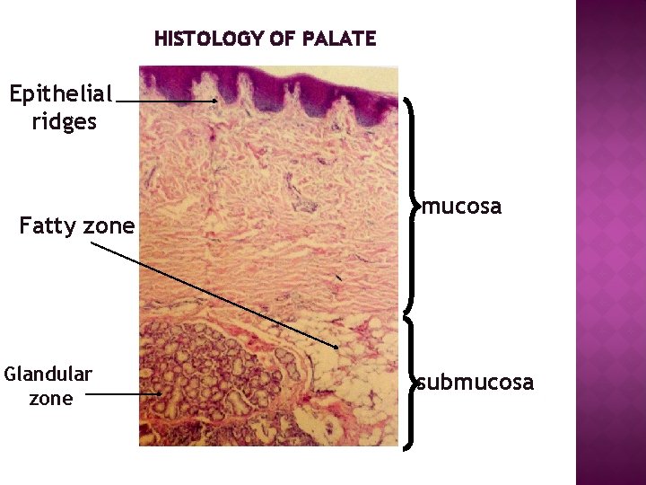 HISTOLOGY OF PALATE Epithelial ridges Fatty zone Glandular zone mucosa submucosa 