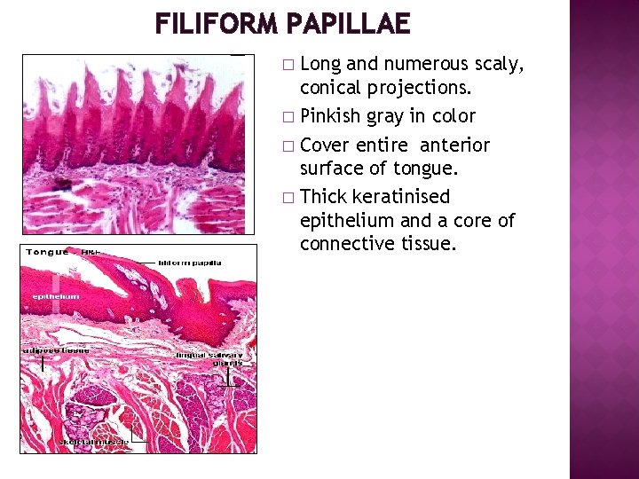 FILIFORM PAPILLAE Long and numerous scaly, conical projections. � Pinkish gray in color �