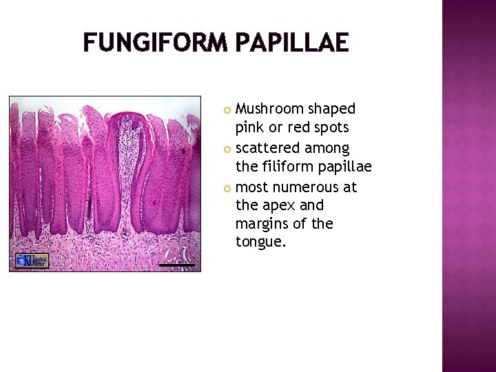 FUNGIFORM PAPILLAE Mushroom shaped pink or red spots scattered among the filiform papillae most