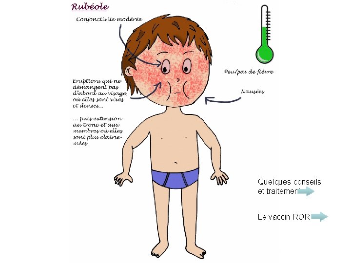 Quelques conseils et traitements Le vaccin ROR 