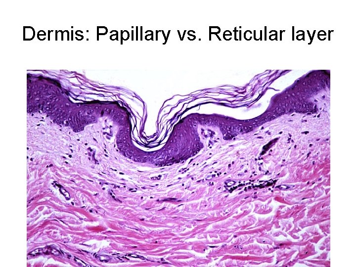 Dermis: Papillary vs. Reticular layer 