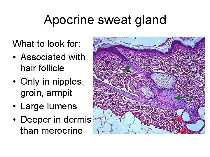 Apocrine sweat gland What to look for: • Associated with hair follicle • Only