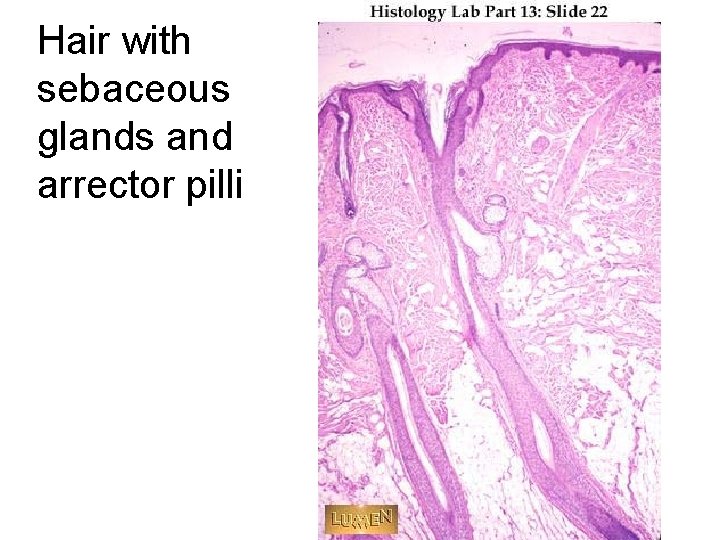 Hair with sebaceous glands and arrector pilli 