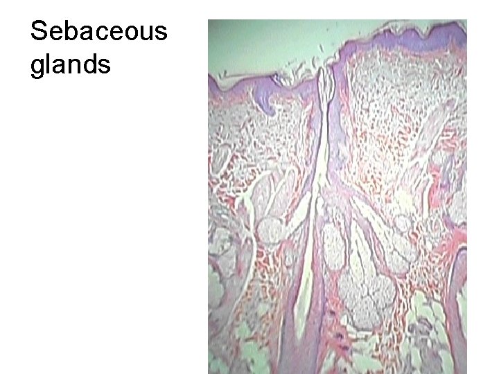 Sebaceous glands 