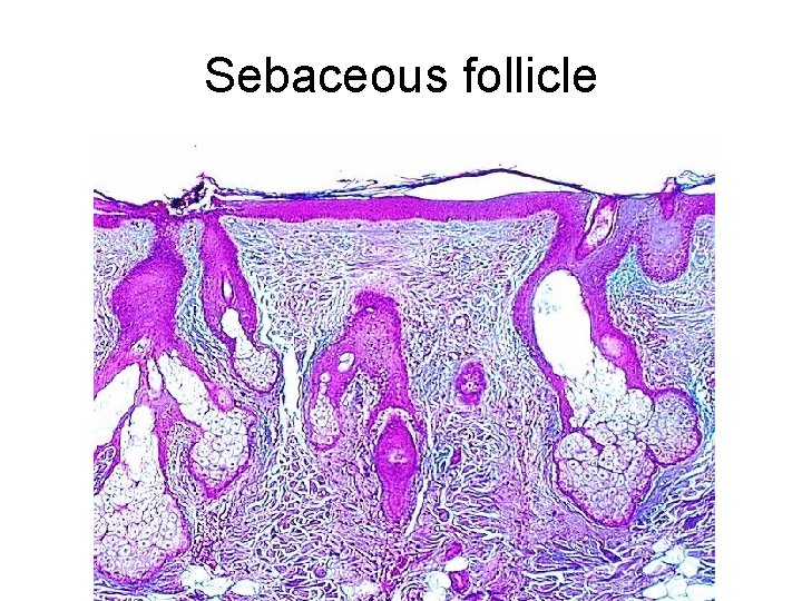 Sebaceous follicle 
