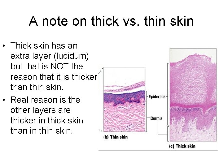 A note on thick vs. thin skin • Thick skin has an extra layer
