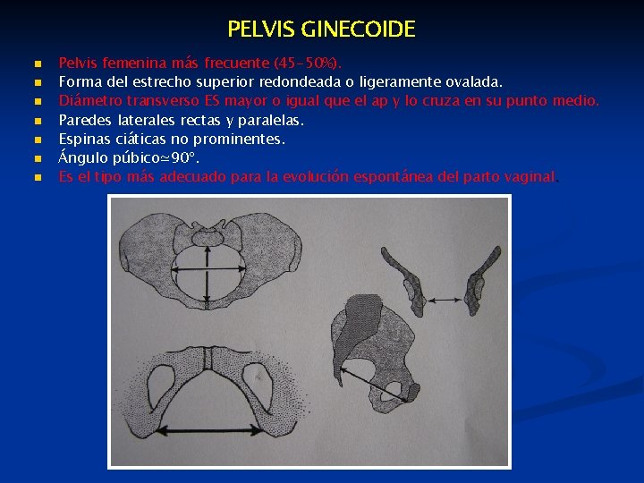 PELVIS GINECOIDE n n n n Pelvis femenina más frecuente (45 -50%). Forma del