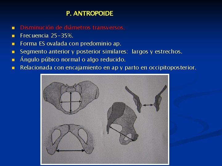 P. ANTROPOIDE n n n Disminución de diámetros transversos. Frecuencia 25 -35%. Forma ES