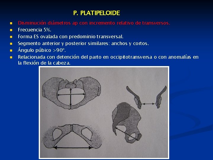 P. PLATIPELOIDE n n n Disminución diámetros ap con incremento relativo de transversos. Frecuencia