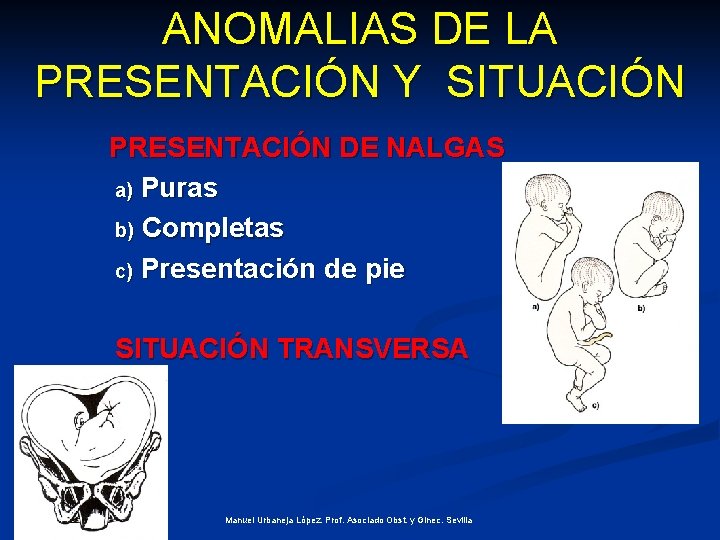 ANOMALIAS DE LA PRESENTACIÓN Y SITUACIÓN PRESENTACIÓN DE NALGAS a) Puras b) Completas c)