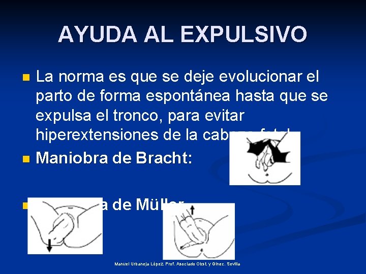 AYUDA AL EXPULSIVO La norma es que se deje evolucionar el parto de forma