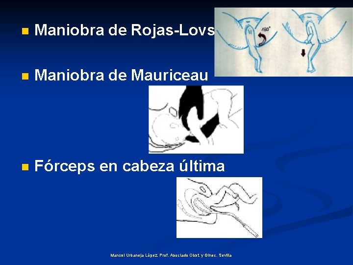 n Maniobra de Rojas-Lovset n Maniobra de Mauriceau n Fórceps en cabeza última Manuel