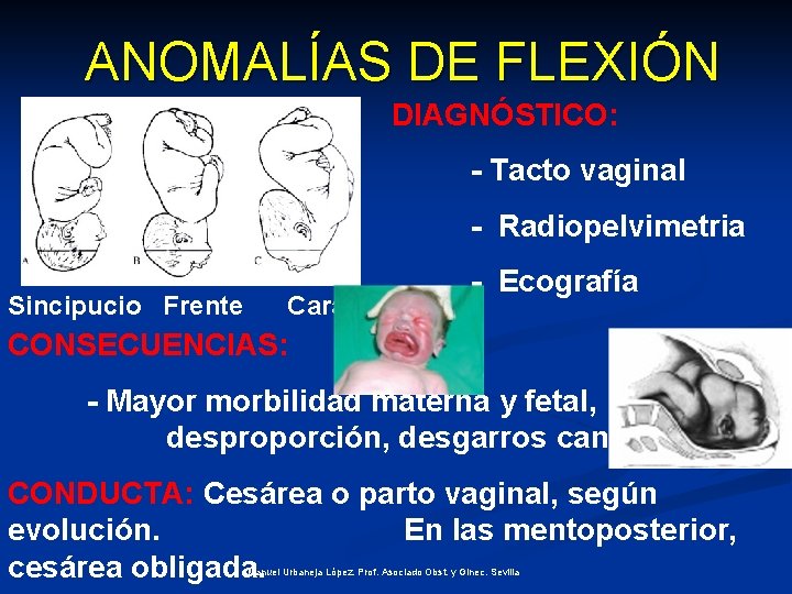 ANOMALÍAS DE FLEXIÓN DIAGNÓSTICO: - Tacto vaginal - Radiopelvimetria Sincipucio Frente Cara - Ecografía